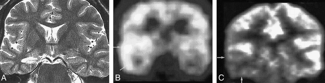 fig 1.
