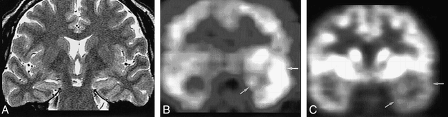 fig 3.