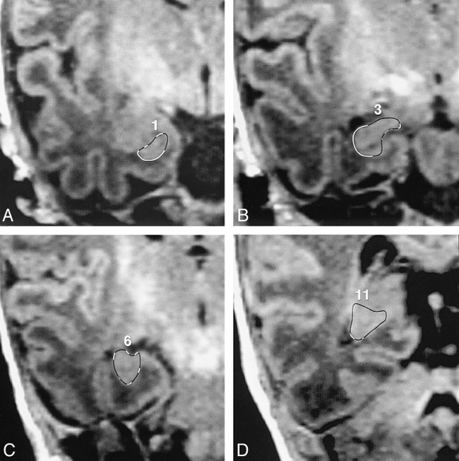 fig 1.