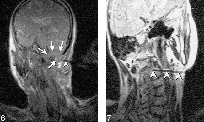 fig 7.