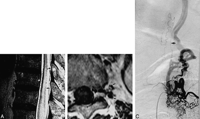 fig 1.