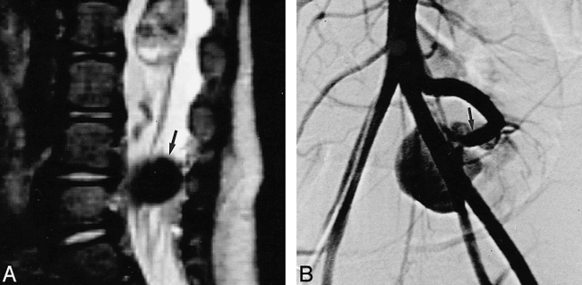 fig 2.