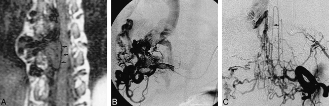 fig 3.