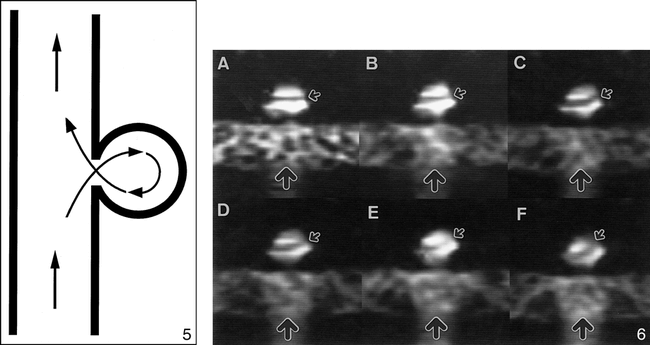 fig 5.