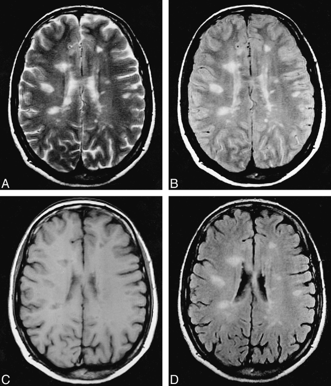fig 1.