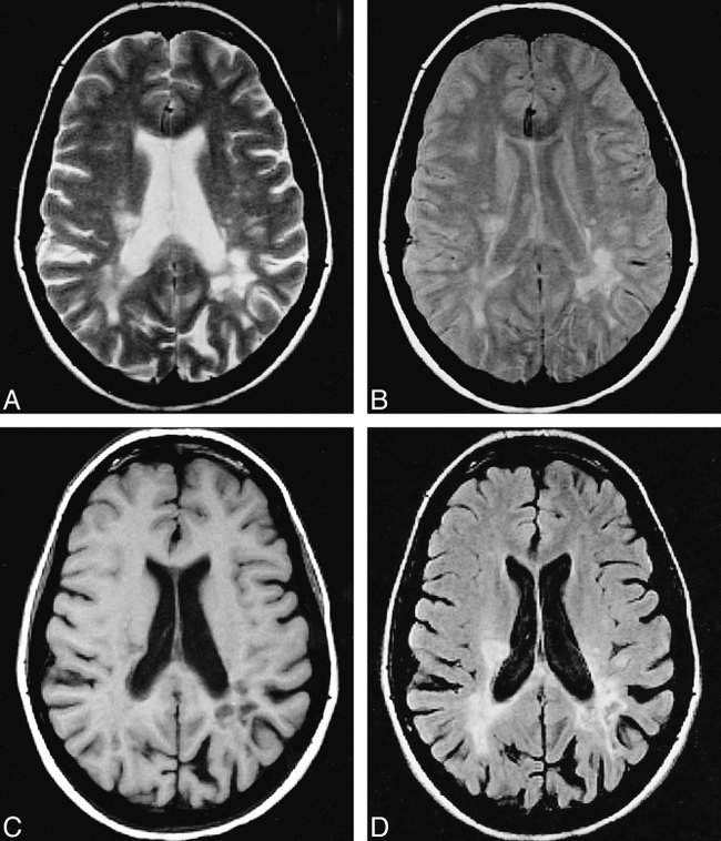 fig 2.