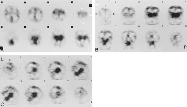fig 1.