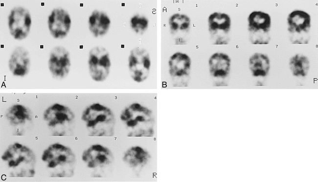 fig 3.