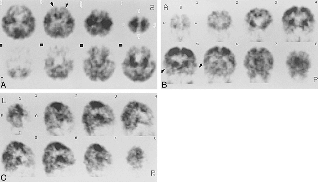 fig 4.