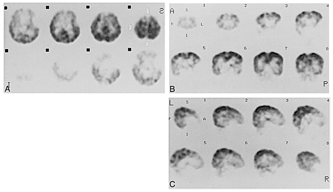 fig 6.