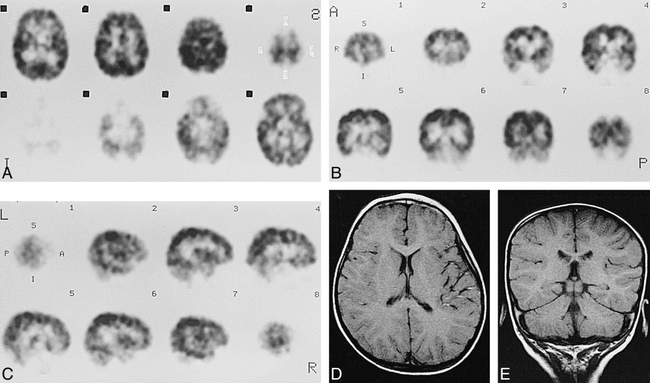 fig 7.