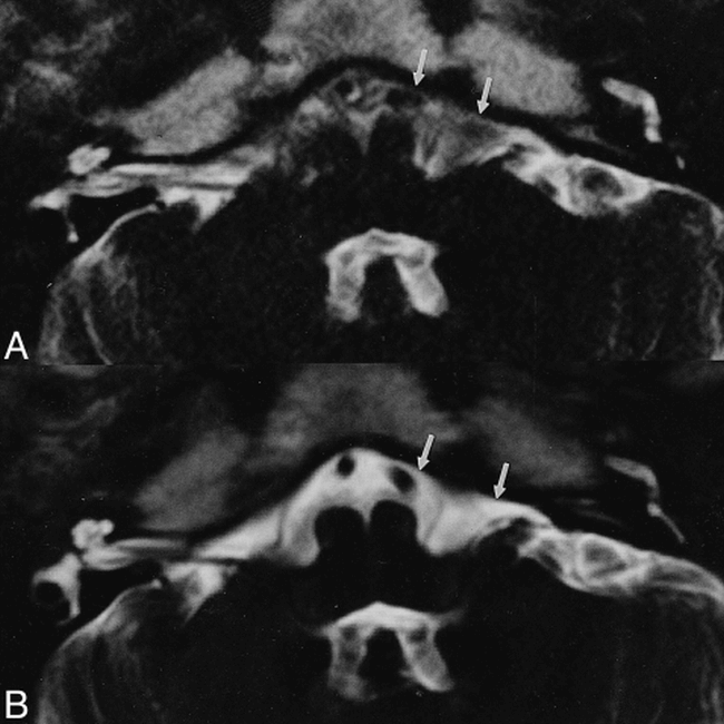 fig 2.