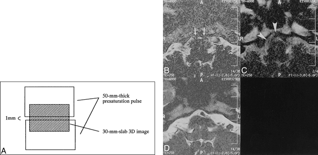 fig 3.