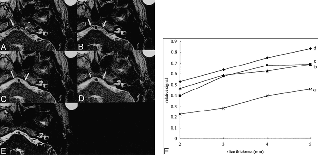 fig 5.
