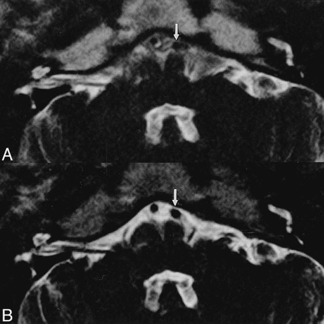 fig 6.