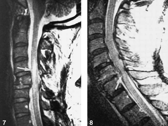 fig 7.
