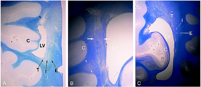 fig 4.