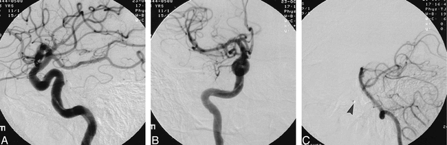 fig 2.