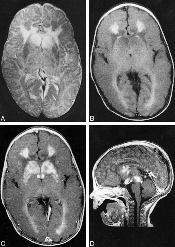 fig 1.