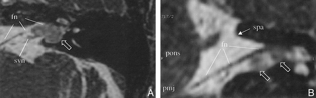 fig 2.