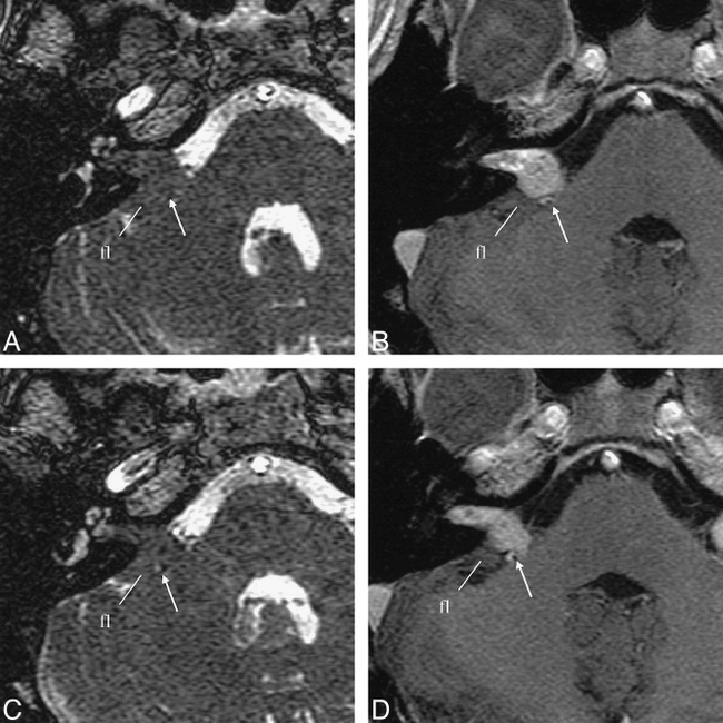 fig 3.