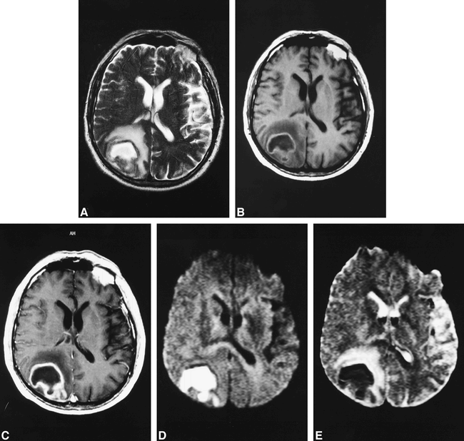 fig 2.