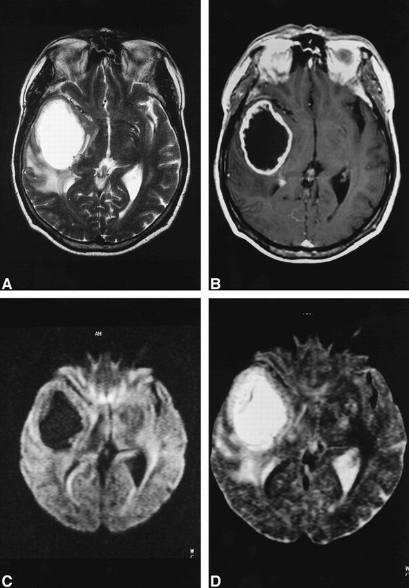 fig 3.