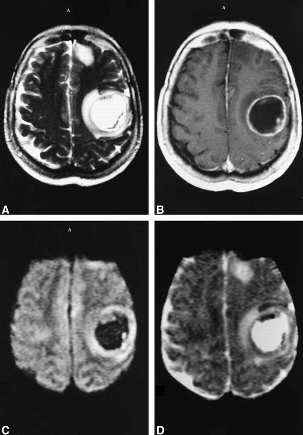 fig 4.
