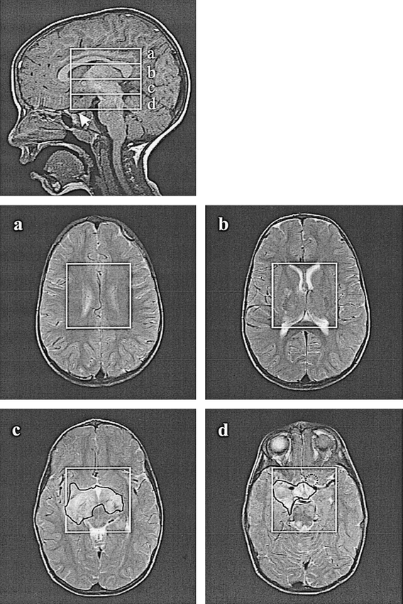 fig 2.