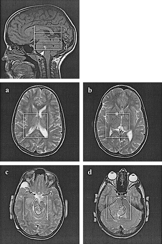fig 4.