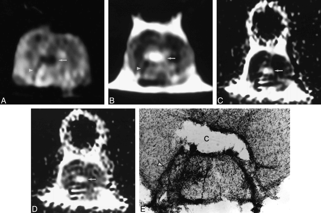 fig 3.