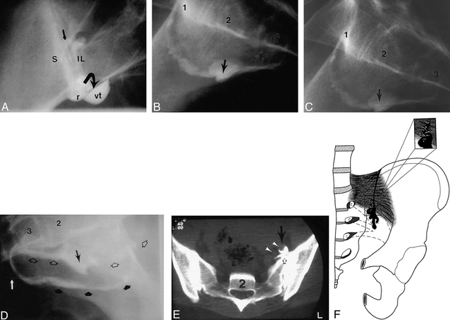 fig 2.