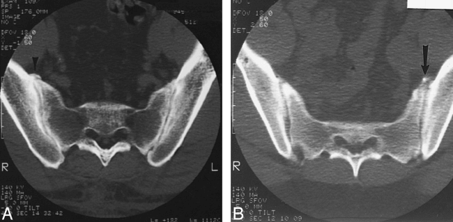 fig 3.