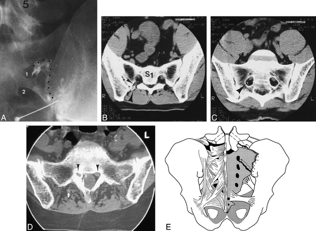 fig 4.
