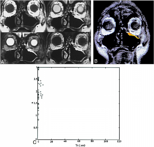 fig 3.