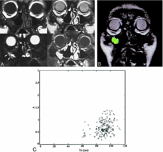 fig 4.