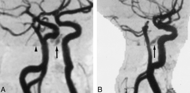 fig 3.