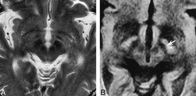 fig 4.