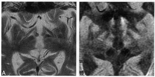 fig 7.