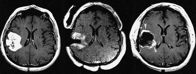 fig 4.