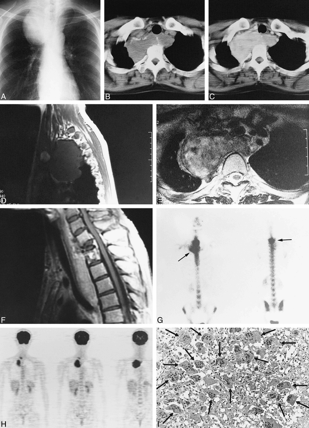 fig 1.