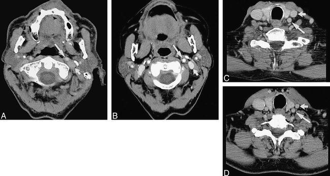 fig 3.