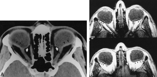 fig 3.