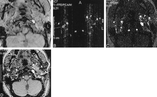 fig 1.
