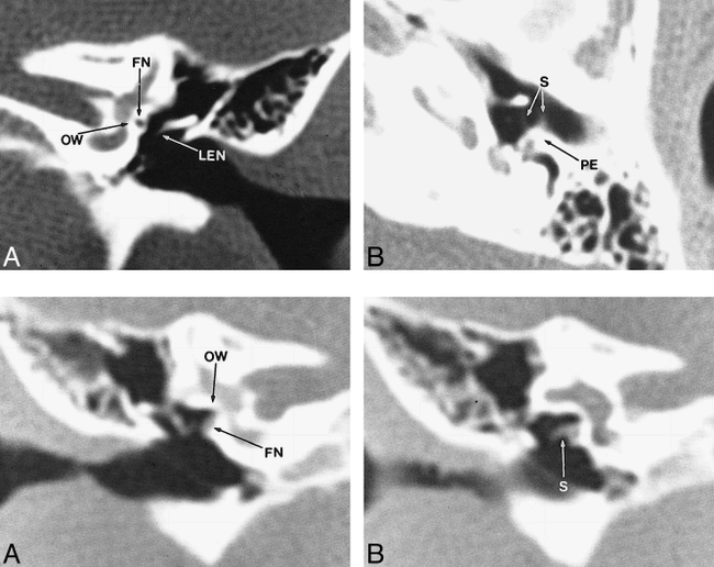 fig 2.