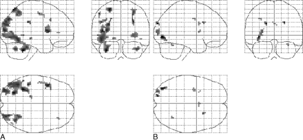 fig 3.