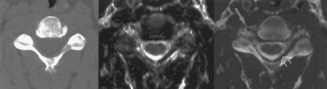 fig 5.
