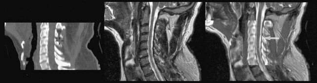 fig 6.
