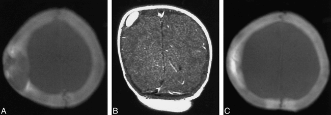 FIG 1.