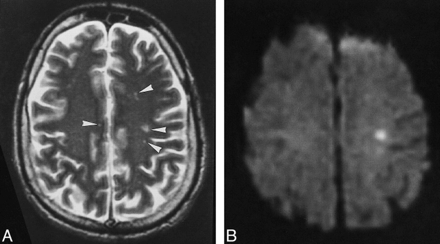 fig 1.